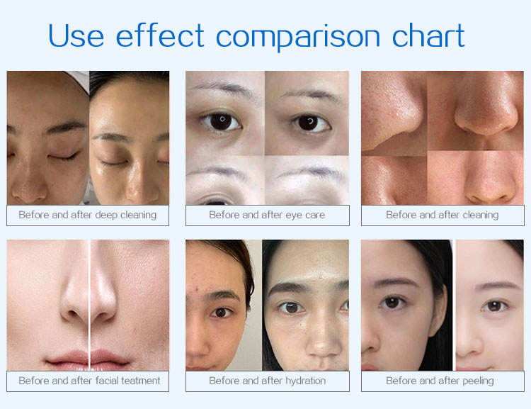Аппарат HydraFacial 9