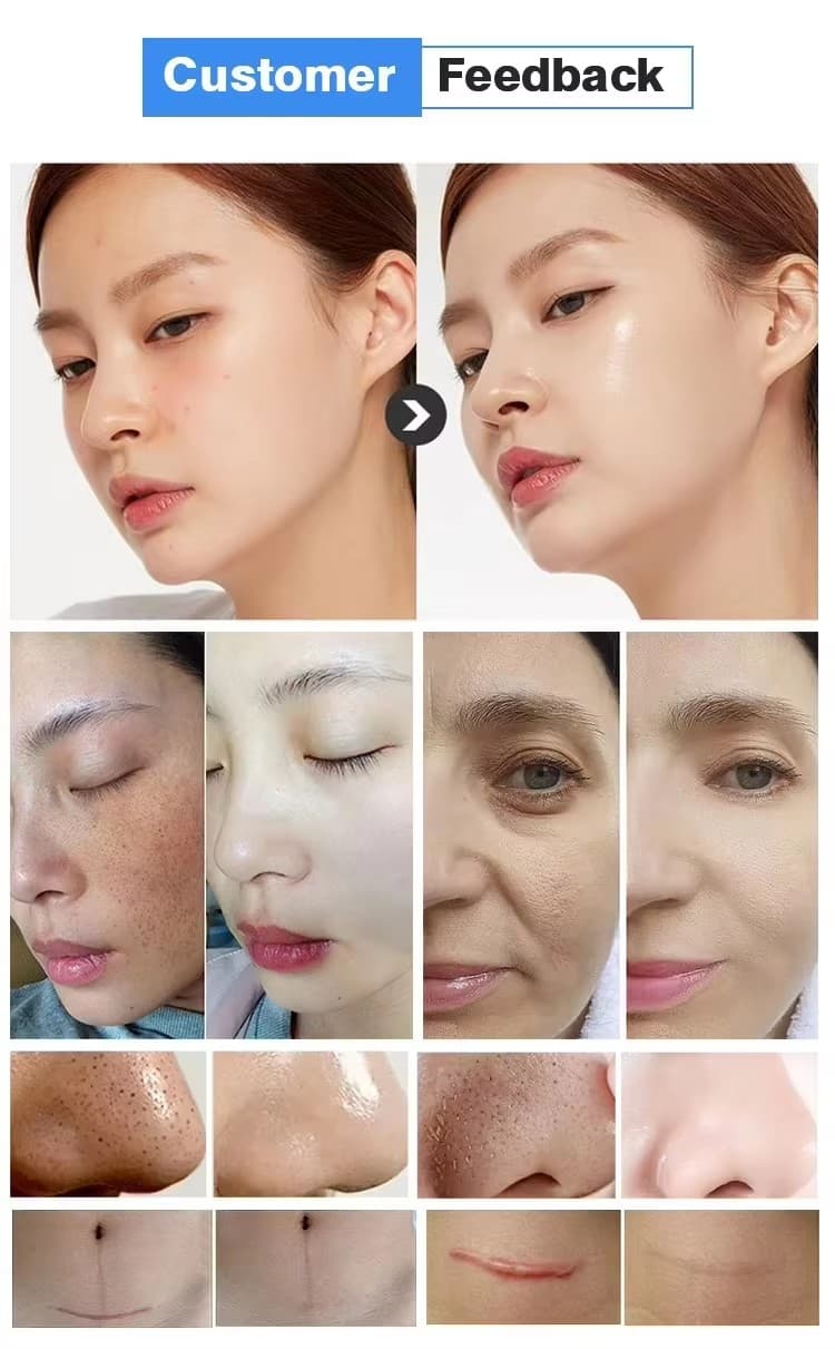 Аппарат HydraFacial 11