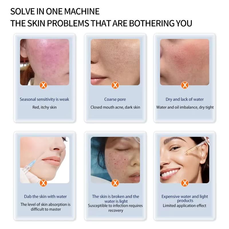 Dispositivo mesoterapia Hello Face3 8