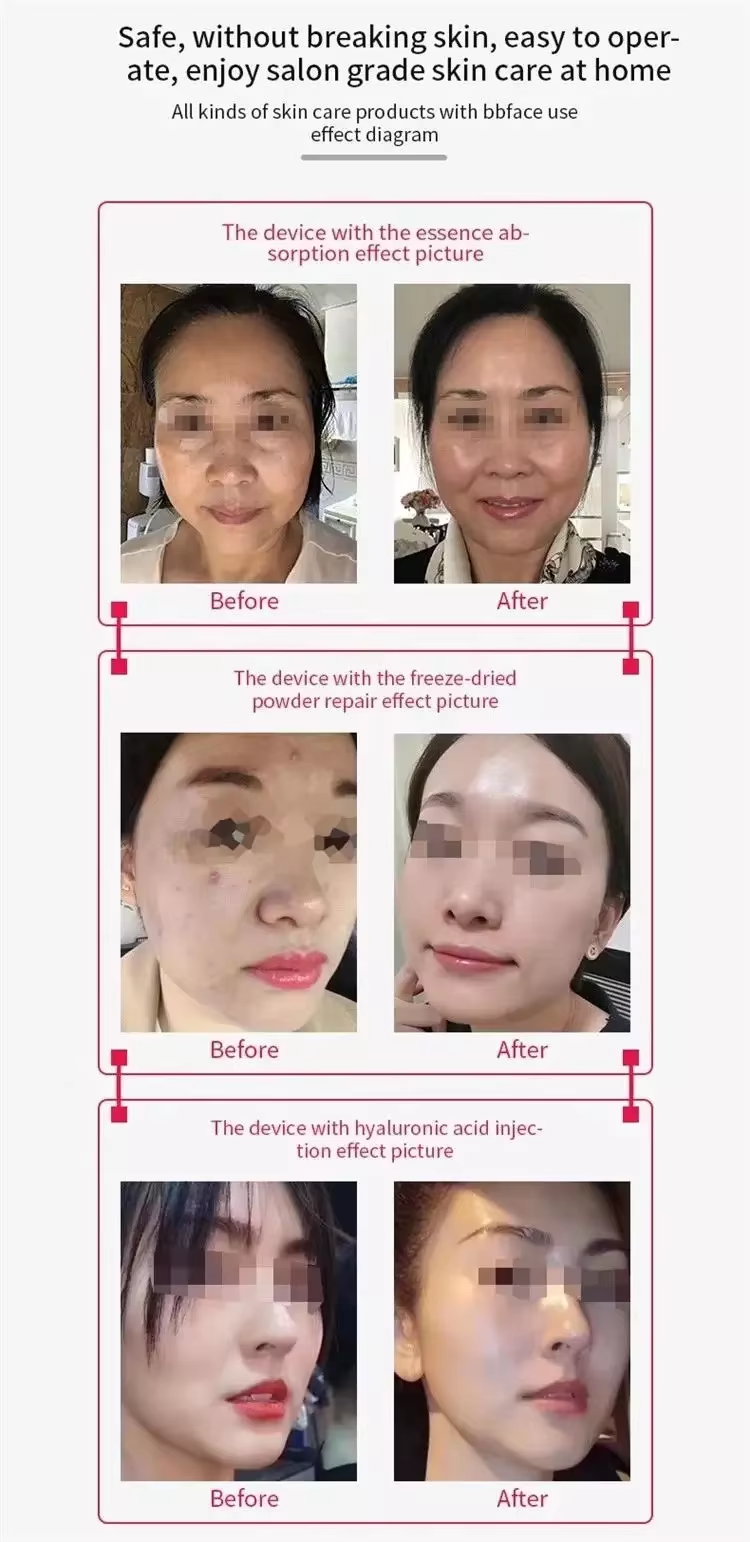 BBface Mesotherapy Machine 8