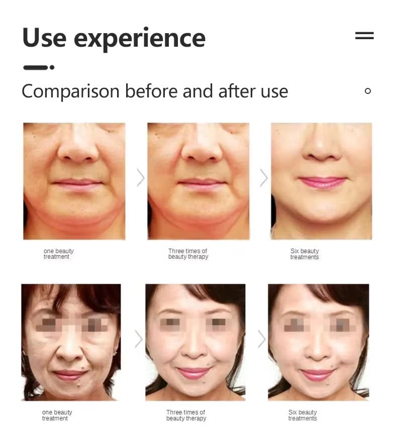 Vmax Lifting facial 8
