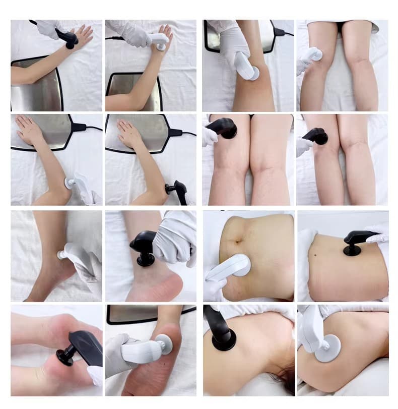 Máquina de fisioterapia por radiofrequência Smart Tecar 448K 11