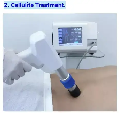 Máquina de terapia por ondas de choque 4