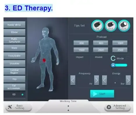 Máquina de terapia por ondas de choque 5