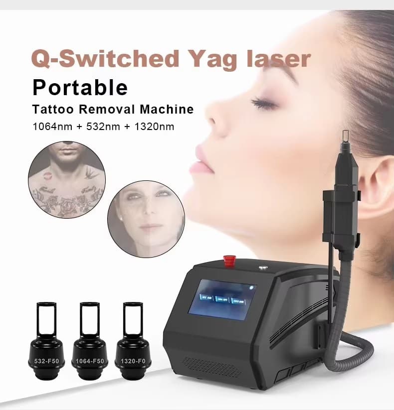 New Picosecond Laser 1064 Nm 755nm 532nm  10