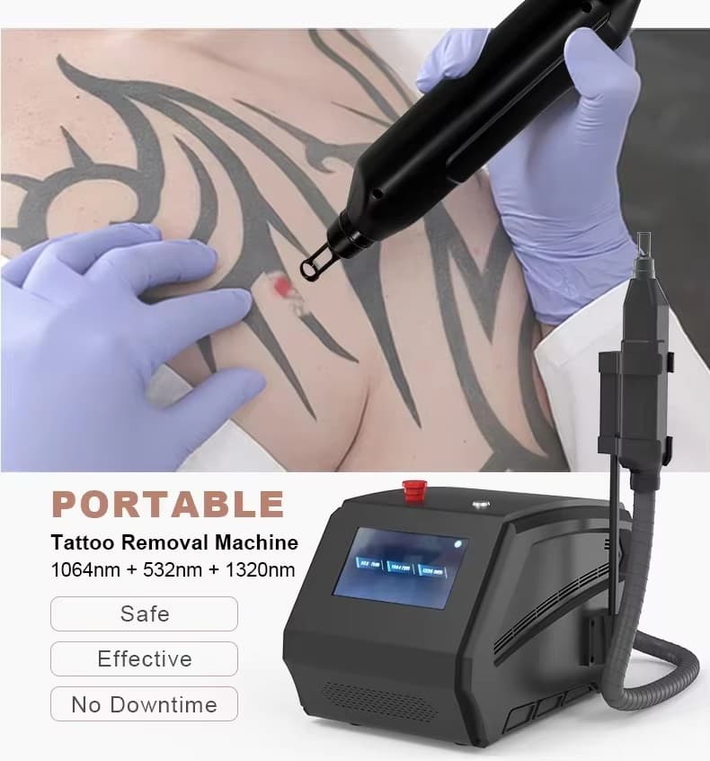 New Picosecond Laser 1064 Nm 755nm 532nm  13