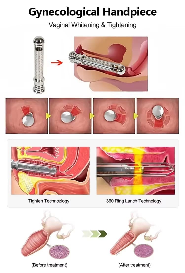 60w Co2 Fractional Laser 9