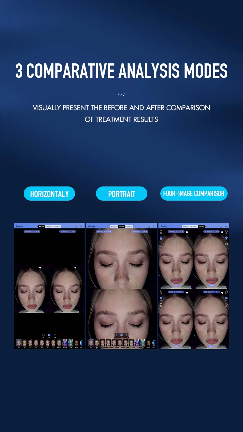 Portable Facial Skin Imager Skin Analyzer Machine 12