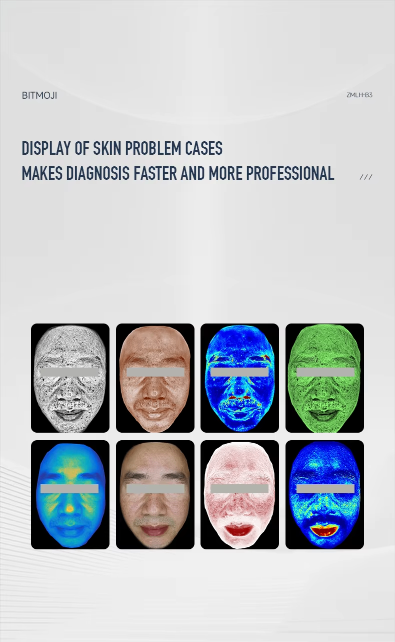 Portable Facial Skin Imager Skin Analyzer Machine 13